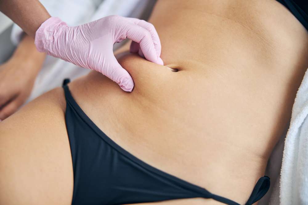 non surgical fat removal