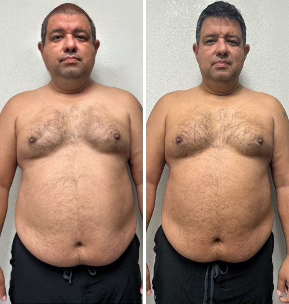 drjantiagingclinic - Banner - Before After Weight Loss-min