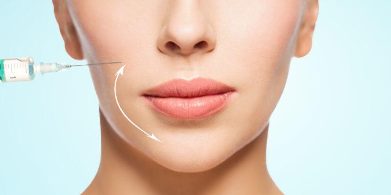 Dermal Fillers