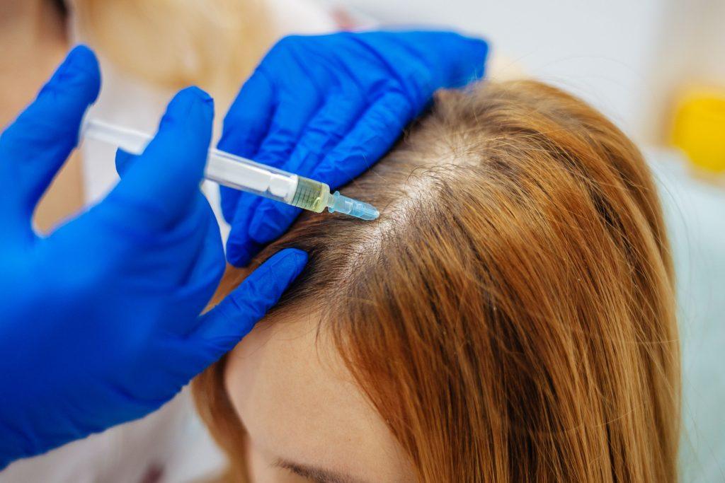 Stem cell hair treatment